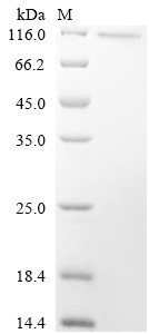 Histone-lysine N-methyltransferase EZH2 (EZH2), human, recombinant