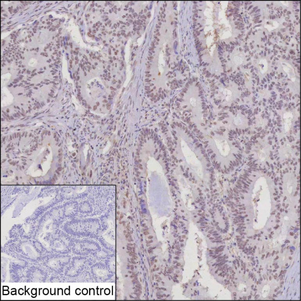 Anti-Transcription Factor E3