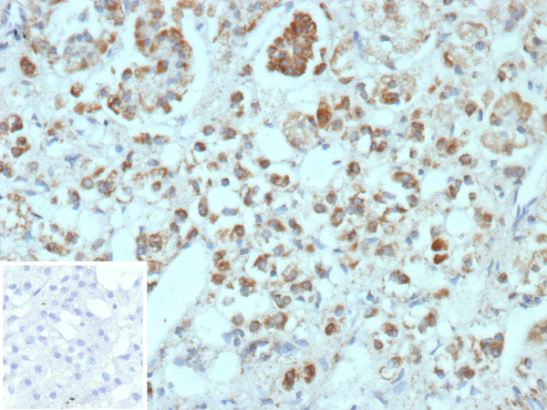 Anti-CXCR5 (Marker of T Follicular Helper (Tfh) Cells), clone CXCR5/13098