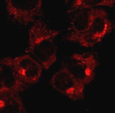 Anti-RAB1