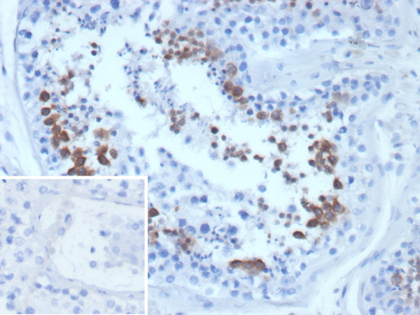 Anti-CETN1 / Centrin-1, clone CETN1/9877