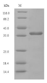 Diphosphoinositol polyphosphate phosphohydrolase DDP1 (DDP1), Saccharomyces cerevisiae, recombinant