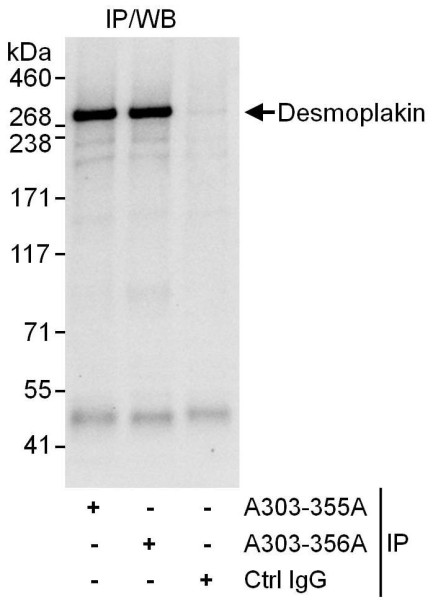 Anti-Desmoplakin