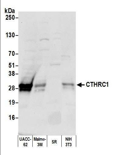 Anti-CTHRC1