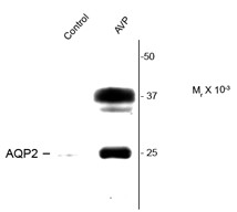 Anti-phospho-Aquaporin 2 (Ser264)