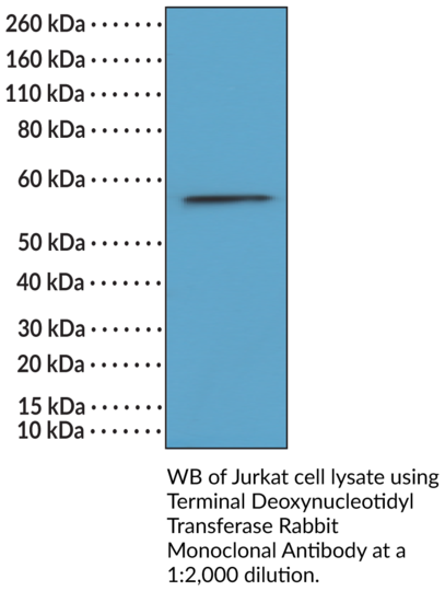 Anti-Terminal Deoxynucleotidyl Transferase Rabbit Monoclonal Antibody (Clone RM379)