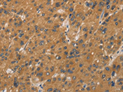 Anti-CYP17A1