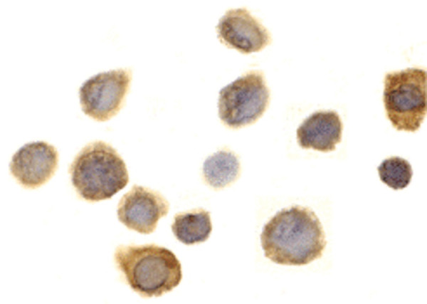 Anti-CD172a / SIRP alpha