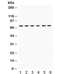 Anti-LIM Kinase 2 / LIMK2