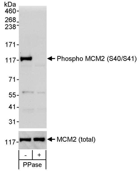 Anti-phospho-MCM2 (Ser40/Ser41)