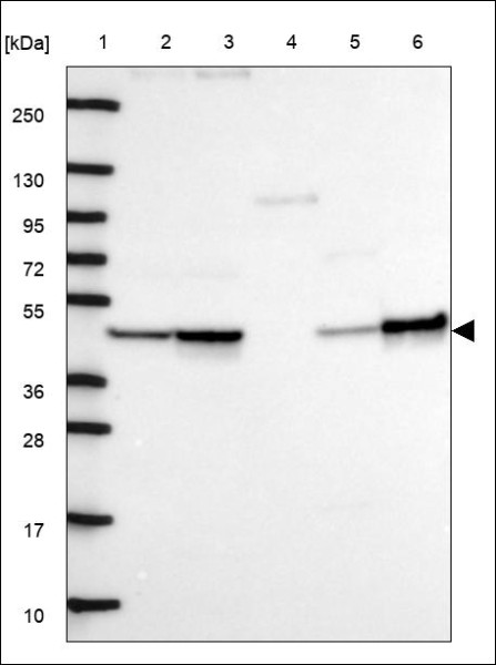 Anti-GPBP1