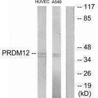 Anti-PRDM12
