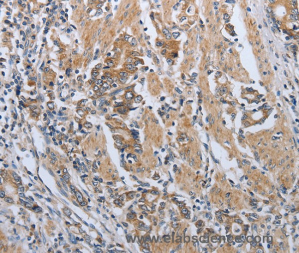 Anti-PDCD1