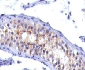 Anti-Prolactin Receptor, clone PRLR742