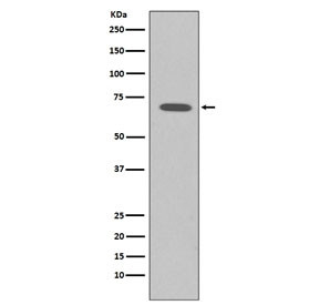 Anti-Raf1 / c-Raf, clone BEC-18