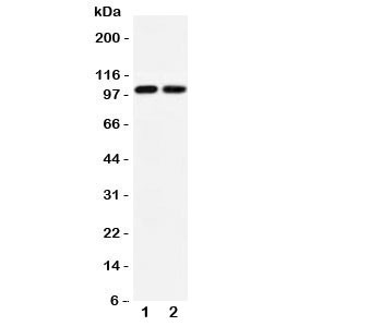 Anti-GLUR3