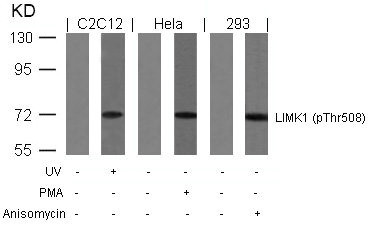 Anti-Phospho-LIMK1 (Thr508)