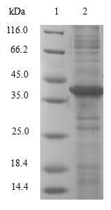 Galectin-2 (LGALS2), human, recombinant