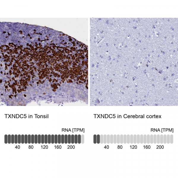 Anti-TXNDC5