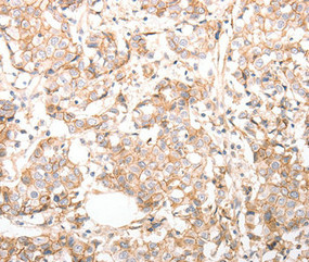 Anti-CDH23