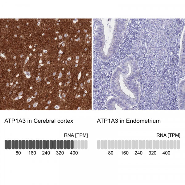 Anti-ATP1A3