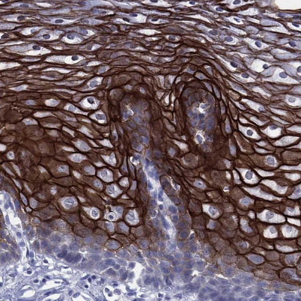 Anti-TGM1
