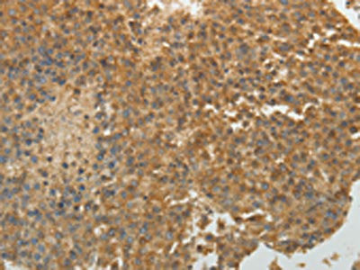 Anti-SULT1E1