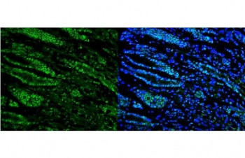 Anti-DHX9 / RNA Helicase A