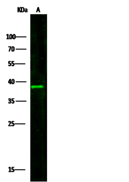 Anti-IL3RA/CD123 Monoclonal Recombinant Antibody