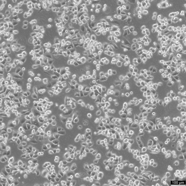 SK-BR-3 Cells
