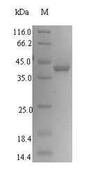 Signal-regulatory protein gamma (SIRPG), partial, human, recombinant