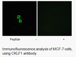 Anti-CKLF1