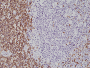 Anti-CD5 (human), Rabbit Monoclonal (RM314)