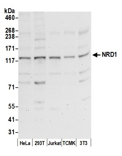 Anti-NRD1/Nardilysin