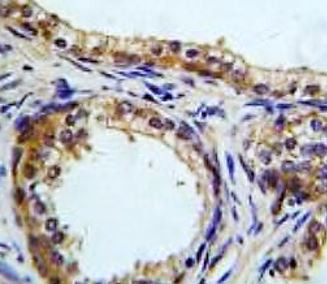 Anti-CREB3L1 / OASIS