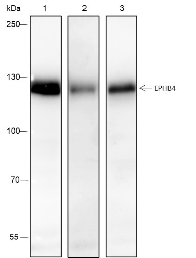 Anti-Recombinant EPHB4, clone A214