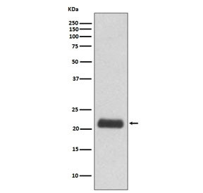 Anti-GPX1 / Glutathione Peroxidase 1, clone IHO-7