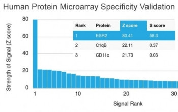 Anti-Estrogen Receptor beta, clone ESR2/3005
