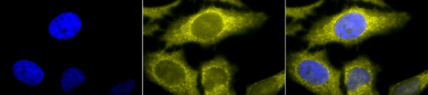 Anti-TCP1 alpha, clone 91a