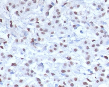 Anti-WT1 / Wilms Tumor 1, clone MMWT1-1