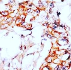 Anti-NAE1 / APPBP1