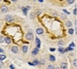 Anti-GRK2
