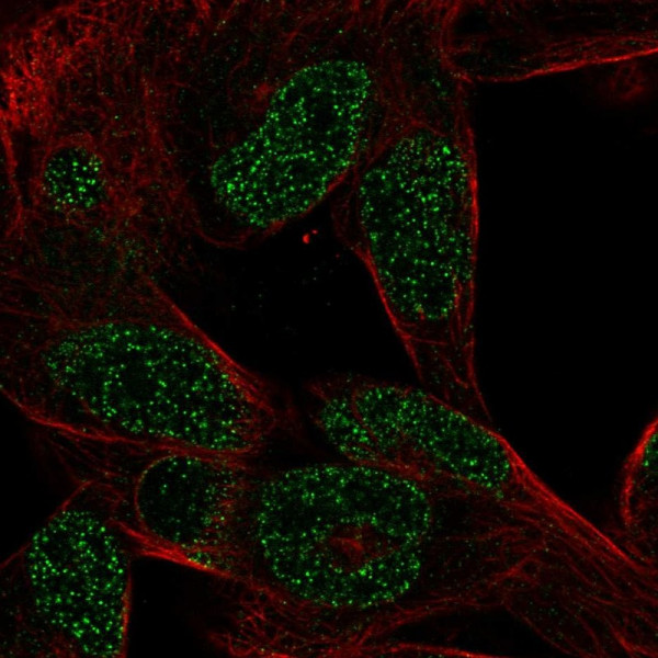 Anti-CTHRC1