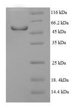 Nuclear receptor subfamily 1 group I member 3 (NR1I3), partial, human, recombinant