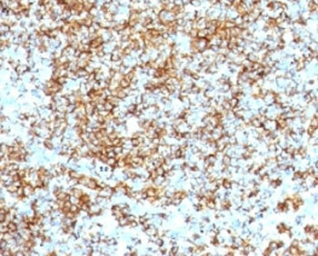 Anti-CD45RB (B-cell marker), clone SPM569