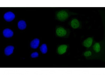 Anti-AMOT / Angiomotin