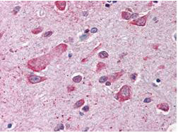 Anti-Cullin-1, CT (CUL-1)