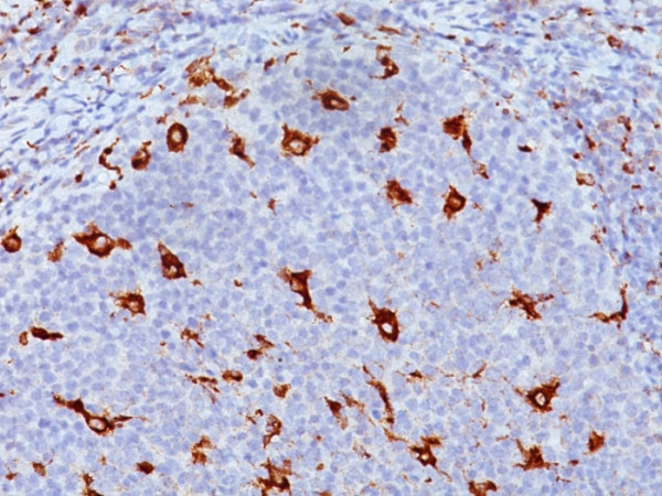 Anti-CD68 (Macrophage Marker), clone KP1