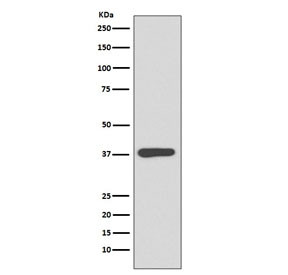 Anti-Maltose Binding Protein / malE / MBP tag, clone BD-13