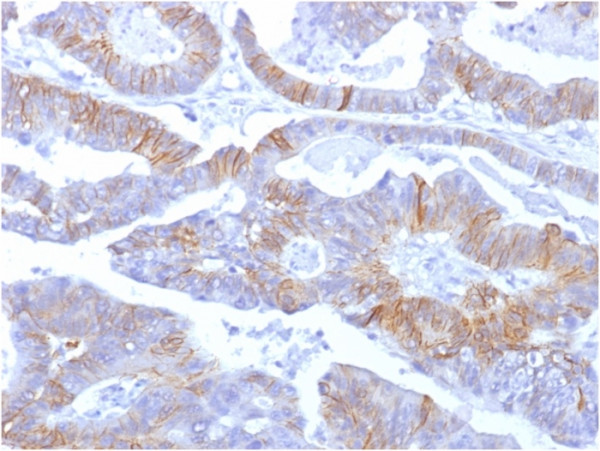 Anti-E-Cadherin/ CD324 (Intercellular Junction Marker), clone SPM381